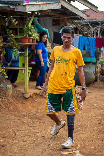 Prosthesis recipient Joey Bolandrina walks confidently around his neighborhood with an old prosthesis of his left leg from Tzu Chi Foundation.
