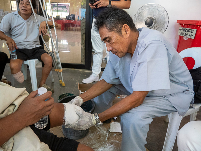 Volunteer prosthetic technician Jose Waldemar Rico from Tzu Chi Zamboanga casts a patient’s amputated leg.