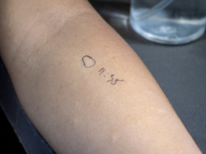 In the dental area, an allergy test was conducted to ensure that medicines are safely administered to the patient.