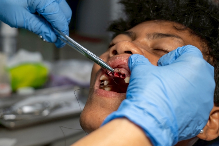 The dental team recorded the highest number of cases, with long queues observed on both Day 1 and Day 2. Despite the volume of patients, they were able to serve a total of 862 consultations.