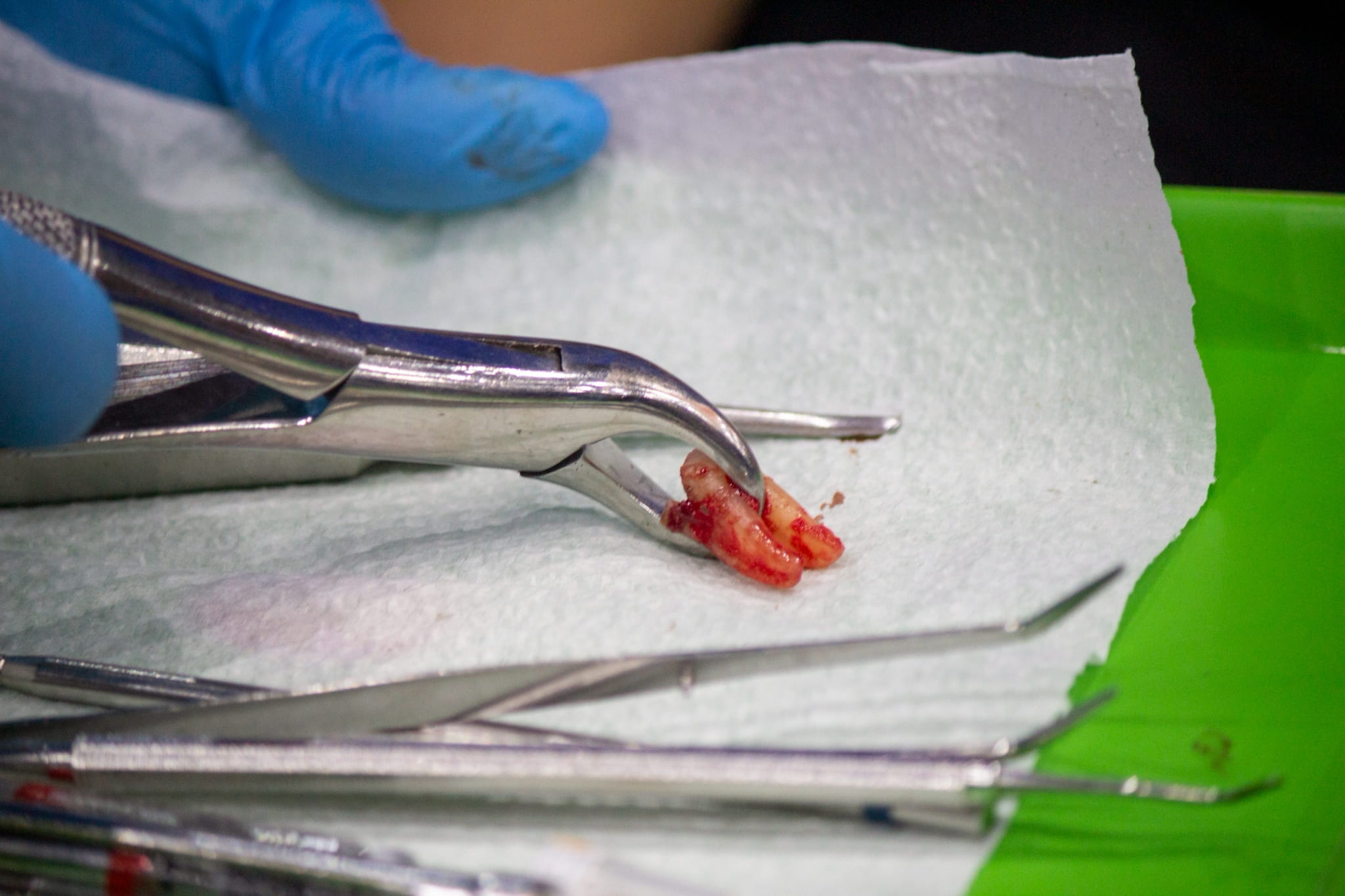 Some patients present complex dental cases.