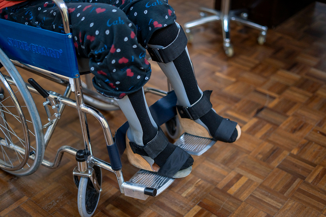 Rica Serrano wears bilateral ankle-foot orthoses that help support her legs and improve her balance.