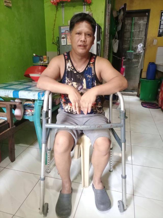 Although Michael Molve’s right knee appears okay after two months in a cast, it didn’t heal completely, and for a while, he depended on a walker. 