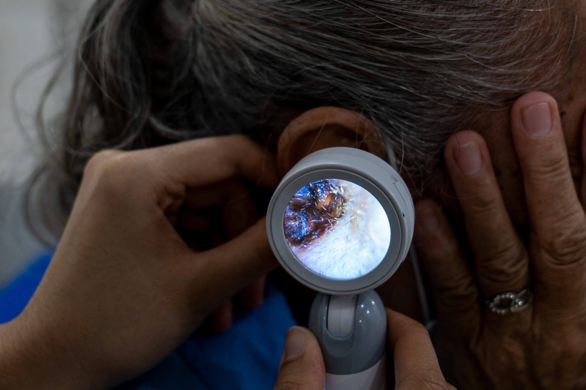 Patients receive free ear check-ups and consultations from the ENT team.