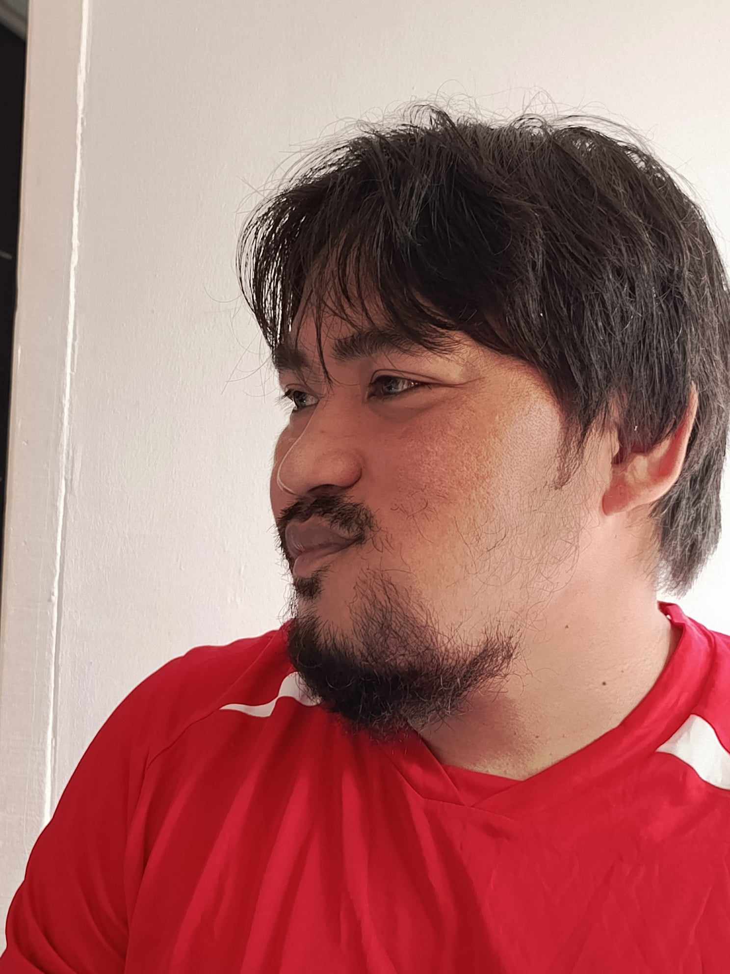 In May 2023, Mechel was diagnosed with ameloblastoma, a benign tumor in the jawbone that significantly affected his daily life, impacting his confidence, speech, eating, and overall functioning due to persistent pain. 