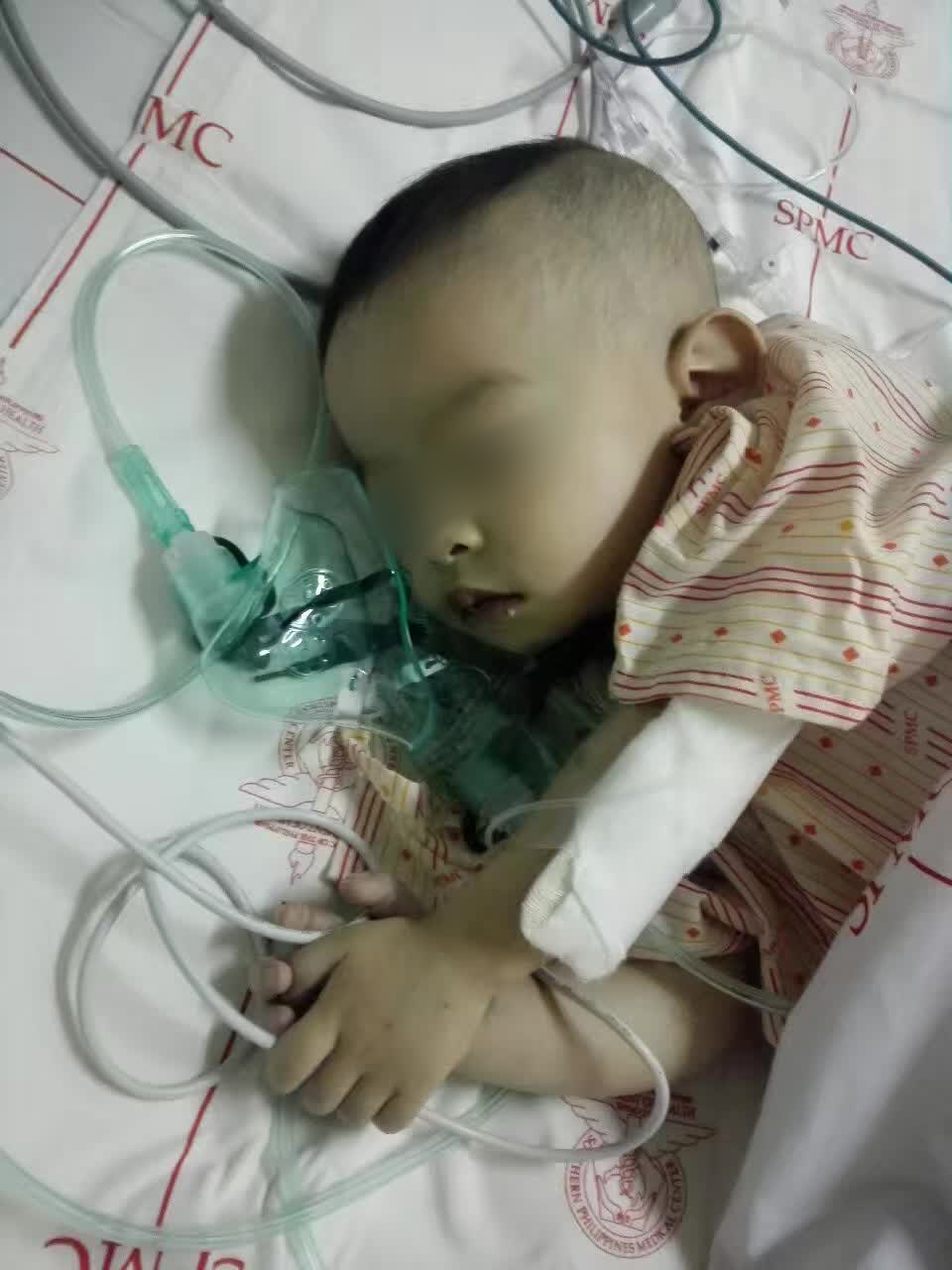 One-year-old Sam Anthony Tan in the ICU after his open-heart surgery in April 2017.