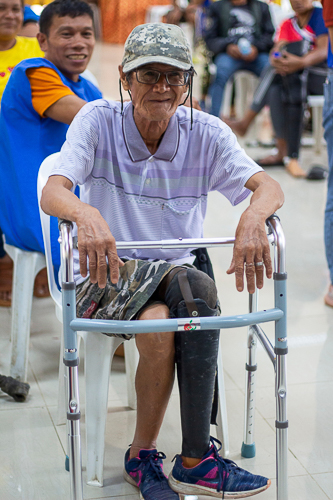 With his new prosthesis fitting comfortably, Bienvenido Espelita can easily sit and pose for a photo.