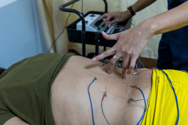After consultation, Monyeen Subingsubing undergoes acupuncture. 【Photo by Harold Alzaga】