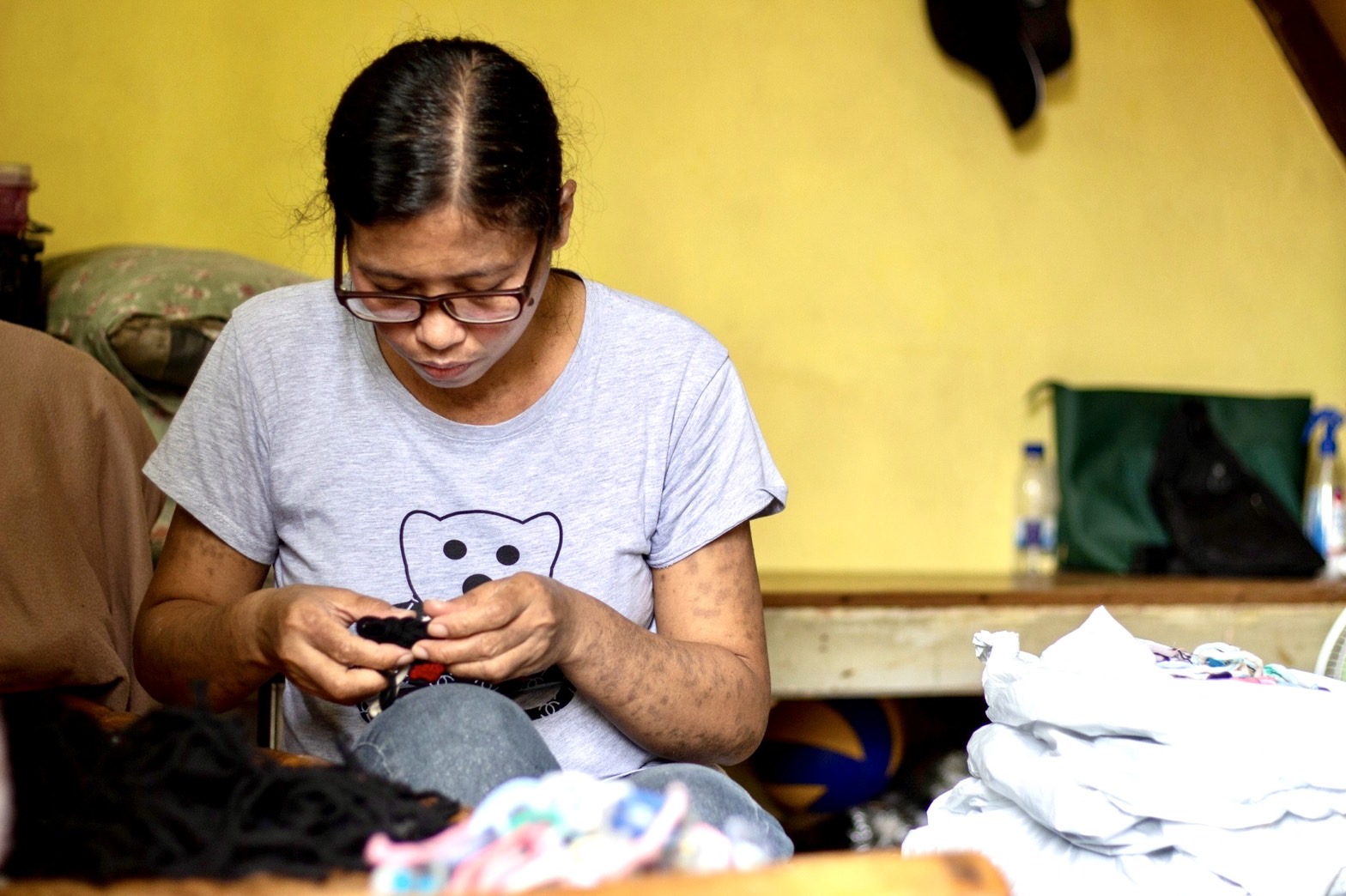 Medical beneficiary Marisol Peñaflorida has lupus. Lesions in her arms are sensitive to sun exposure, thus limiting her work options and time outdoors. Weaving mats for Tzu Chi’s livelihood program allows her to work and earn without having to leave home. 【Photo by Harold Alzaga】 